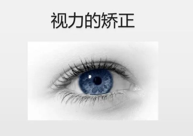 星视力视力矫正